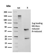 Angiotensin I Converting Enzyme (ACE)/CD143 Antibody in SDS-PAGE (SDS-PAGE)