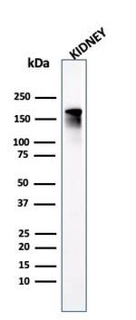 Angiotensin I Converting Enzyme (ACE)/CD143 Antibody in Western Blot (WB)