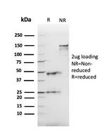 Angiotensin I Converting Enzyme (ACE)/CD143 Antibody in SDS-PAGE (SDS-PAGE)