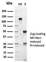 Angiotensin I Converting Enzyme (ACE)/CD143 Antibody in SDS-PAGE (SDS-PAGE)