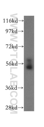 TXNRD2 Antibody in Western Blot (WB)