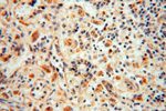 VAV1 Antibody in Immunohistochemistry (Paraffin) (IHC (P))