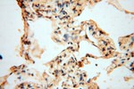 VAV1 Antibody in Immunohistochemistry (Paraffin) (IHC (P))