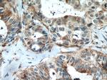 VAV1 Antibody in Immunohistochemistry (Paraffin) (IHC (P))