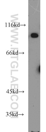 VAV1 Antibody in Western Blot (WB)