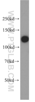 HNRNPU Antibody in Western Blot (WB)