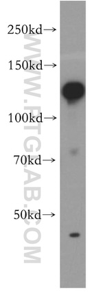 HNRNPU Antibody in Western Blot (WB)