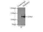 HNRNPU Antibody in Immunoprecipitation (IP)