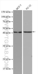 SHOX2 Antibody in Western Blot (WB)