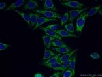 FZR1 Antibody in Immunocytochemistry (ICC/IF)