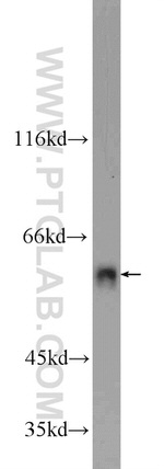 FZR1 Antibody in Western Blot (WB)