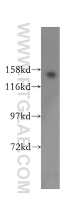 WAPL/WAPAL Antibody in Western Blot (WB)