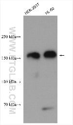 WAPL/WAPAL Antibody in Western Blot (WB)