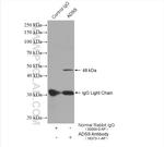 ADSS Antibody in Immunoprecipitation (IP)
