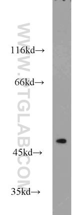 ADSS Antibody in Western Blot (WB)