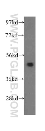 ADSS Antibody in Western Blot (WB)