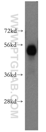 HARS Antibody in Western Blot (WB)