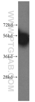 HARS Antibody in Western Blot (WB)