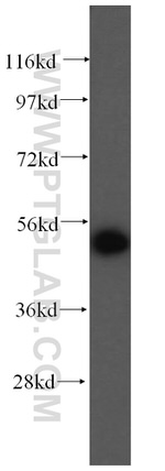 HARS Antibody in Western Blot (WB)