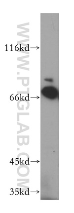 GMPS Antibody in Western Blot (WB)