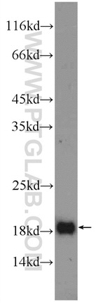 RPP21 Antibody in Western Blot (WB)