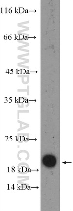 RPP21 Antibody in Western Blot (WB)