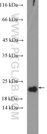 RPP21 Antibody in Western Blot (WB)