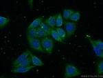 GSNOR/ADH5 Antibody in Immunocytochemistry (ICC/IF)