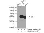 GSNOR/ADH5 Antibody in Immunoprecipitation (IP)