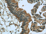 GSNOR/ADH5 Antibody in Immunohistochemistry (Paraffin) (IHC (P))