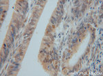 GSNOR/ADH5 Antibody in Immunohistochemistry (Paraffin) (IHC (P))