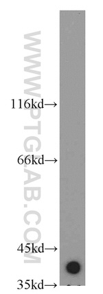 GSNOR/ADH5 Antibody in Western Blot (WB)