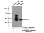 Alpha-1-Antitrypsin Antibody in Immunoprecipitation (IP)