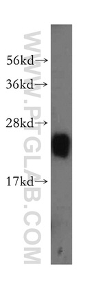 RPL23A Antibody in Western Blot (WB)
