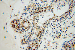 XRCC5/Ku80 Antibody in Immunohistochemistry (Paraffin) (IHC (P))