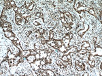 XRCC5/Ku80 Antibody in Immunohistochemistry (Paraffin) (IHC (P))