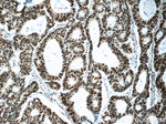 XRCC5/Ku80 Antibody in Immunohistochemistry (Paraffin) (IHC (P))