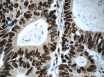 XRCC5/Ku80 Antibody in Immunohistochemistry (Paraffin) (IHC (P))