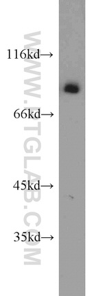 XRCC5/Ku80 Antibody in Western Blot (WB)