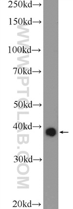 MRM1 Antibody in Western Blot (WB)