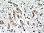 NRF2/NFE2L2 Antibody in Immunohistochemistry (Paraffin) (IHC (P))