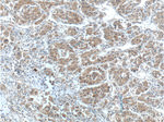 NRF2/NFE2L2 Antibody in Immunohistochemistry (Paraffin) (IHC (P))