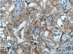 NRF2/NFE2L2 Antibody in Immunohistochemistry (Paraffin) (IHC (P))