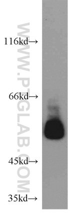 SMAD9 Antibody in Western Blot (WB)