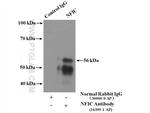 NFIC Antibody in Immunoprecipitation (IP)