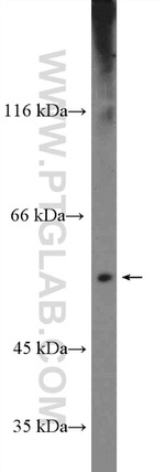 NFIC Antibody in Western Blot (WB)