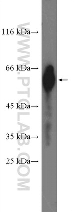 NFIC Antibody in Western Blot (WB)