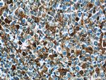 human IgG heavy chain Antibody in Immunohistochemistry (Paraffin) (IHC (P))