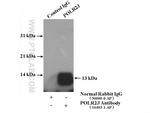 POLR2J Antibody in Immunoprecipitation (IP)