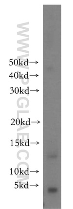 POLR2J Antibody in Western Blot (WB)